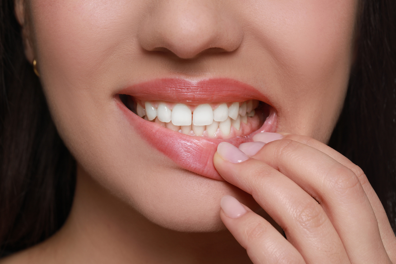 Young Woman Showing Healthy Gums, Closeup View